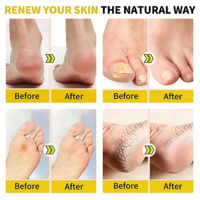 info-400-400 Moisturizing Foot Soak Pods
